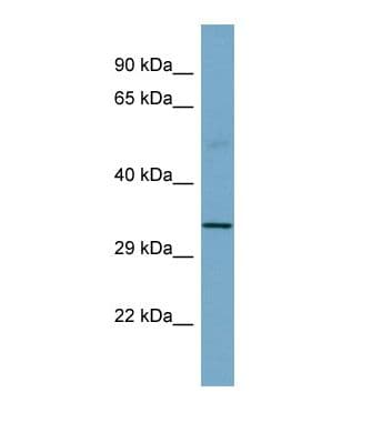 SGCB / SGC / Sarcoglycan Beta Antibody (aa91-140)