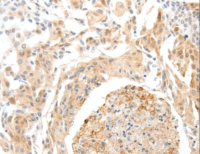 SEMA3D / Semaphorin 3D Antibody