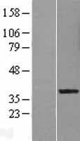 LRRC28 Protein (Over-Expression Lysate Myc-DDK (Flag))