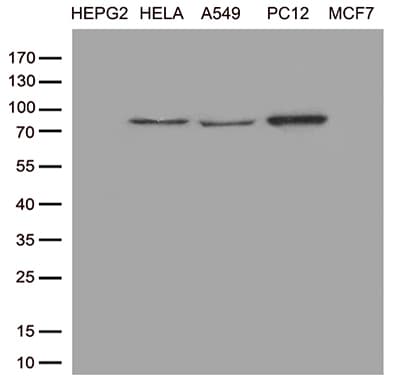 Monoclonal Mouse anti-Human TTC7A Antibody (clone OTI2D3, aa1-450, WB)