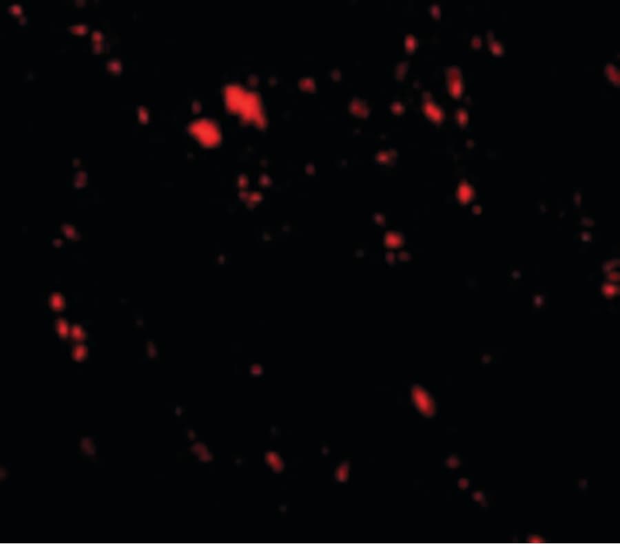 IHC-plus™ Polyclonal Rabbit anti-Human LIMPII / SCARB2 Antibody (IHC, IF, WB)