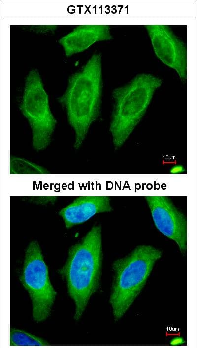 STK24 / MST3 Antibody (aa137-231)