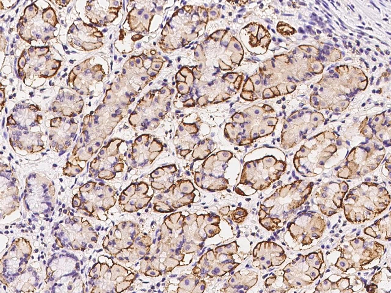 Polyclonal Rabbit anti-Human AKIRIN1 Antibody (IHC)