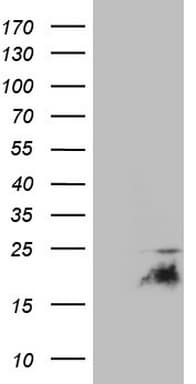 p16INK4a / CDKN2A Antibody (clone OTI13E10)