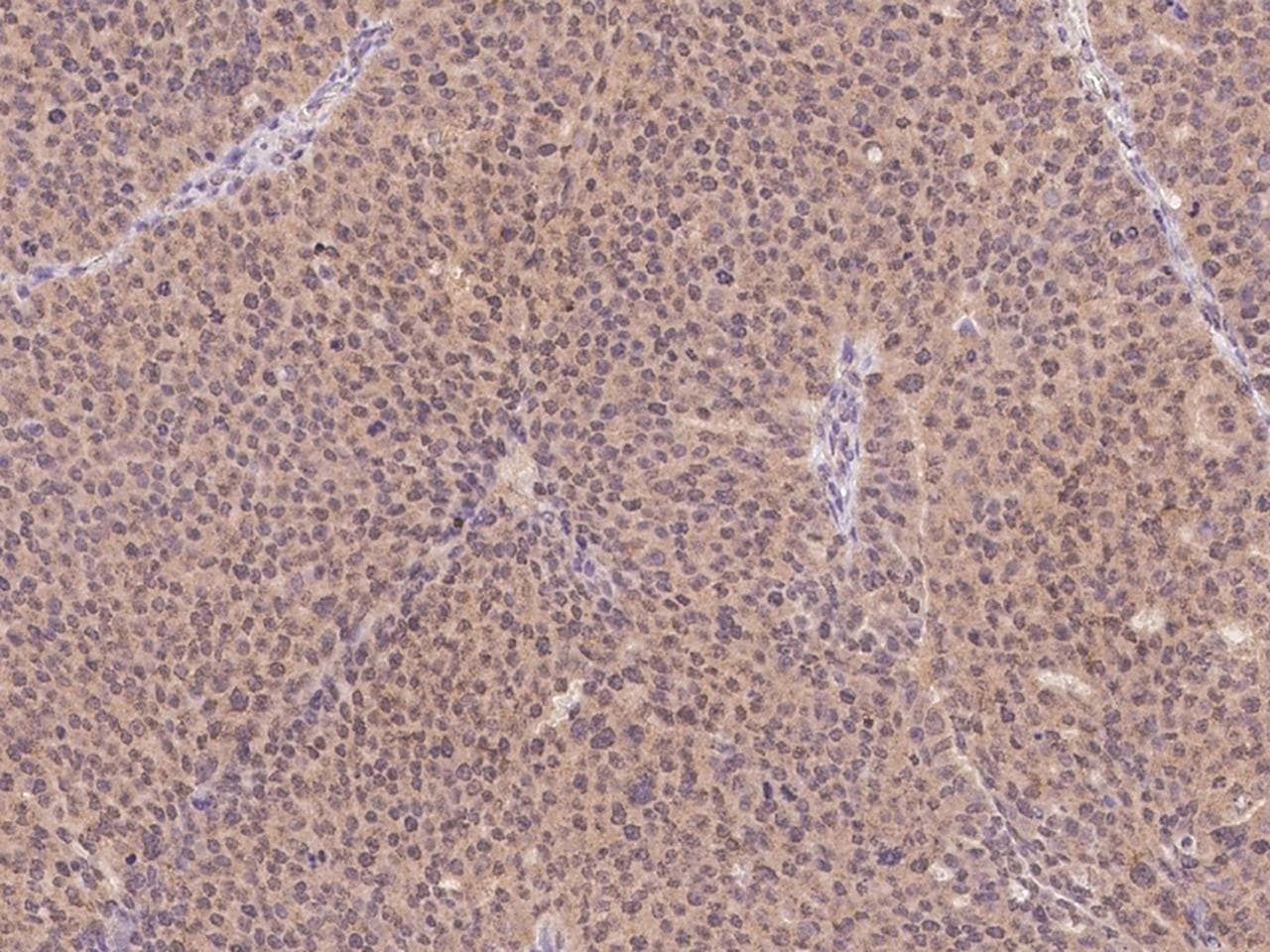 Polyclonal Rabbit anti-Human MMP13 Antibody (IHC)