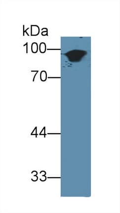 KRT1 / CK1 / Cytokeratin 1 Antibody (aa189-497, Cy3)