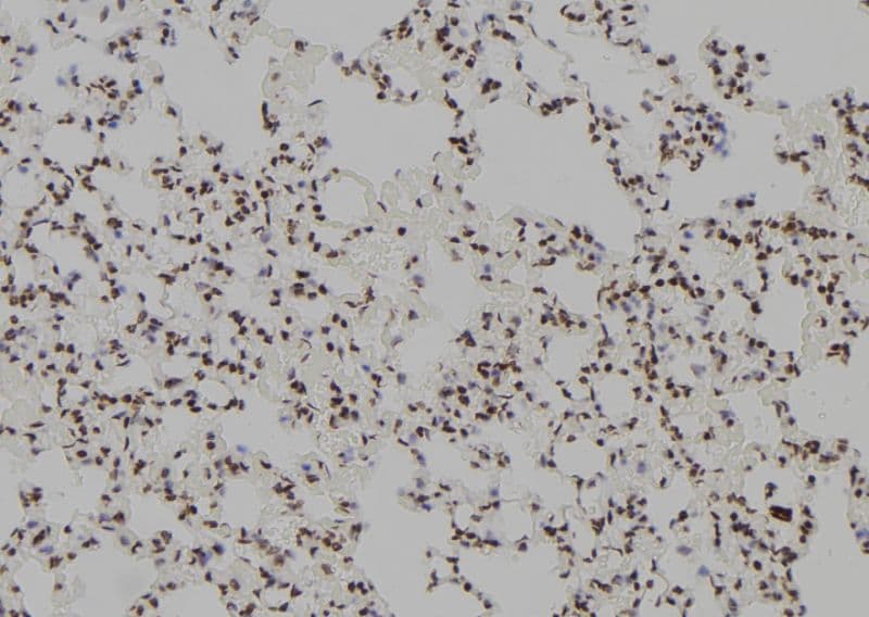 POLR2F Antibody