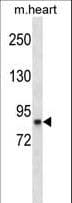 RPS6KA3 / RSK2 Antibody