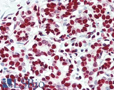 Polyclonal Rabbit Histone Antibody (IHC, WB)