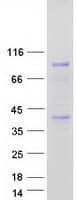 Human ANKZF1 Protein (Recombinant Myc-DDK (Flag))