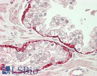 KAT5 / TIP60 Antibody (aa107-156)