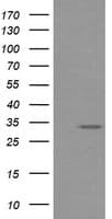 RARRES1 Antibody (clone OTI1H2)