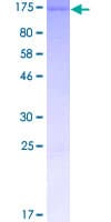Human LPIN1 / Lipin 1 Protein (Recombinant GST)