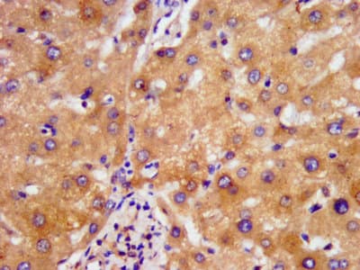 NDUFAF2 / NDUFA12L Antibody