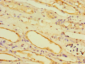 AHCYL1 / DCAL Antibody (aa31-260)