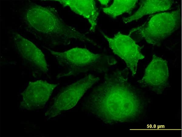ZRP-1 / TRIP6 Antibody (clone 4B7)