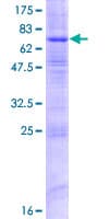 Human ZDHHC9 Protein (Recombinant GST)