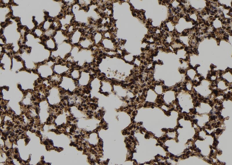 TMPRSS15 / Enterokinase Antibody (aa510-529)