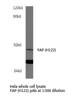 YAP / YAP1 Antibody (His122)