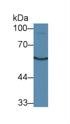 CALCR / Calcitonin Receptor Antibody (aa42-170, PE)