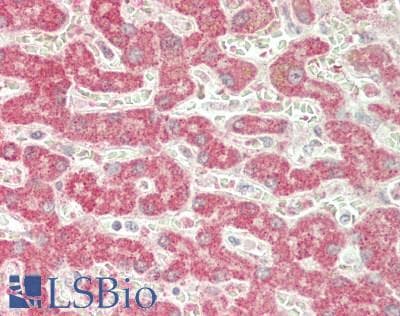 IHC-plus™ Polyclonal Rabbit anti-Human ENTPD5 / CD39L4 Antibody (aa333-362, IHC, WB)