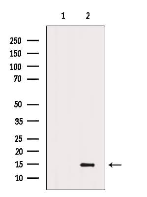 CHCHD10 Antibody