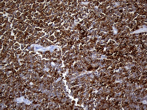 SH3BP1 Antibody (clone OTI2F4)