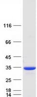 Human NQO1 Protein (Recombinant Myc-DDK (Flag))