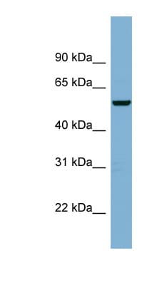 CNOT11 / C2orf29 Antibody (aa215-264)