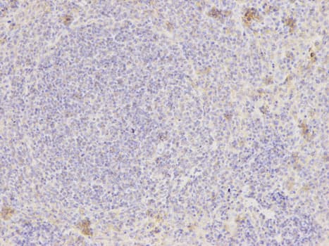 Polyclonal Rabbit anti-Human NAMPT / Visfatin Antibody (IHC, IF, WB)