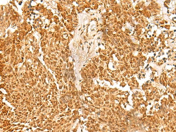 Polyclonal Rabbit anti-Human SSSCA1 / p27 Antibody (IHC, WB)