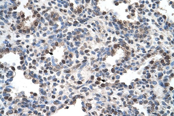 Polyclonal Rabbit anti-Human FAM134B Antibody (aa160-209, IHC, WB)