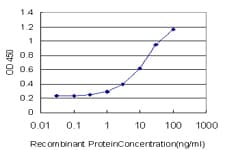 Monoclonal Mouse anti-Human ESR2 / ER Beta Antibody (clone 3F3, IF, WB)
