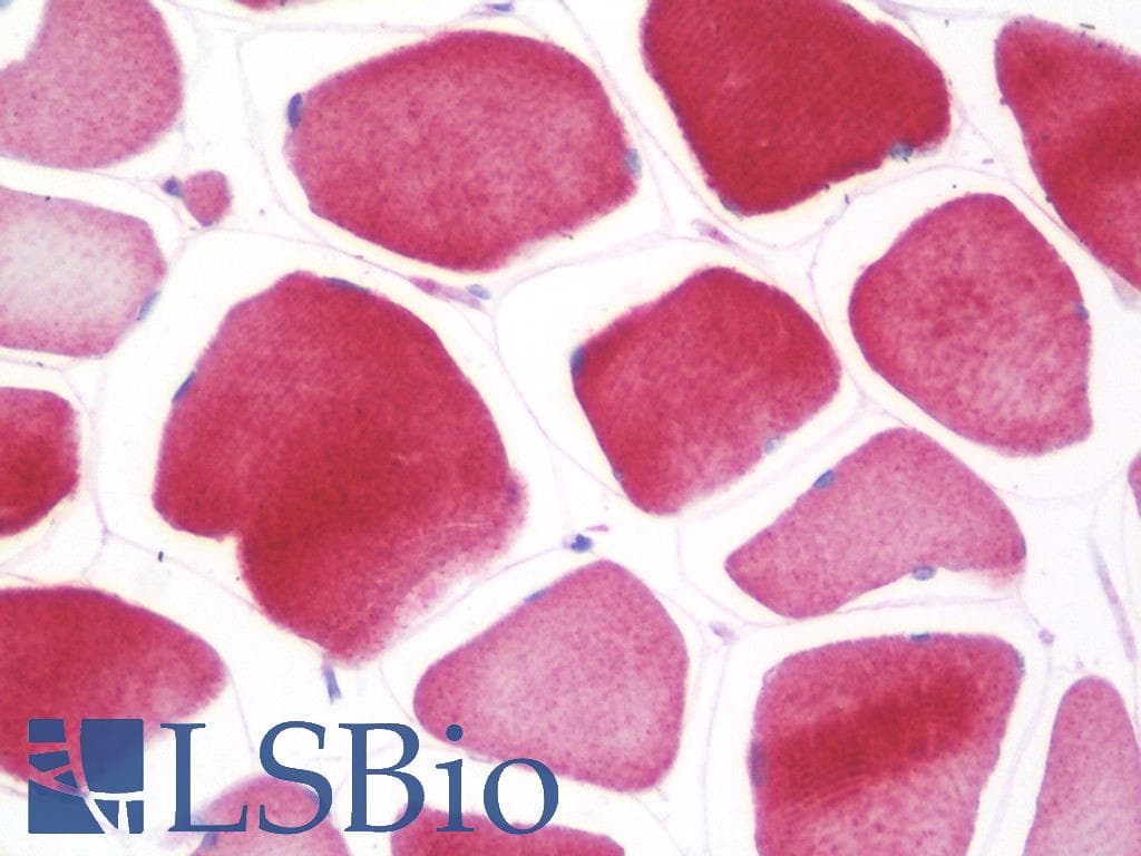 IHC-plus™ CRB1 Antibody