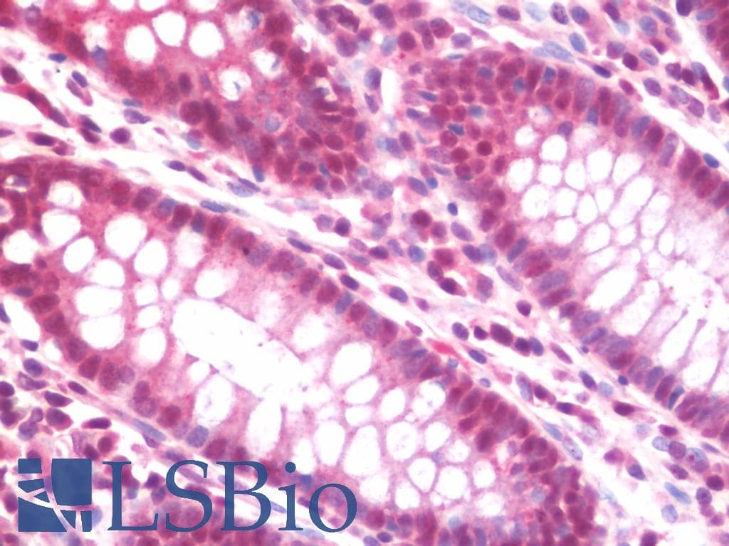 IHC-plus™ AHI1 Antibody (aa1-42)
