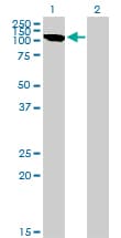 CLCN2 Antibody (clone 3E1)