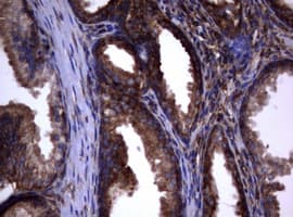 PIK3C2A Antibody (aa230-560, clone OTI4E6)