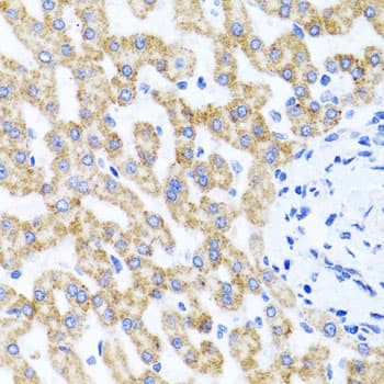 RIP4 / ANKRD3 Antibody