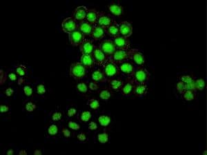 IHC-plus™ BMI1 / PCGF4 Antibody (Internal, clone EPR3745(2))