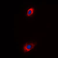 SLC25A31 Antibody (Internal)