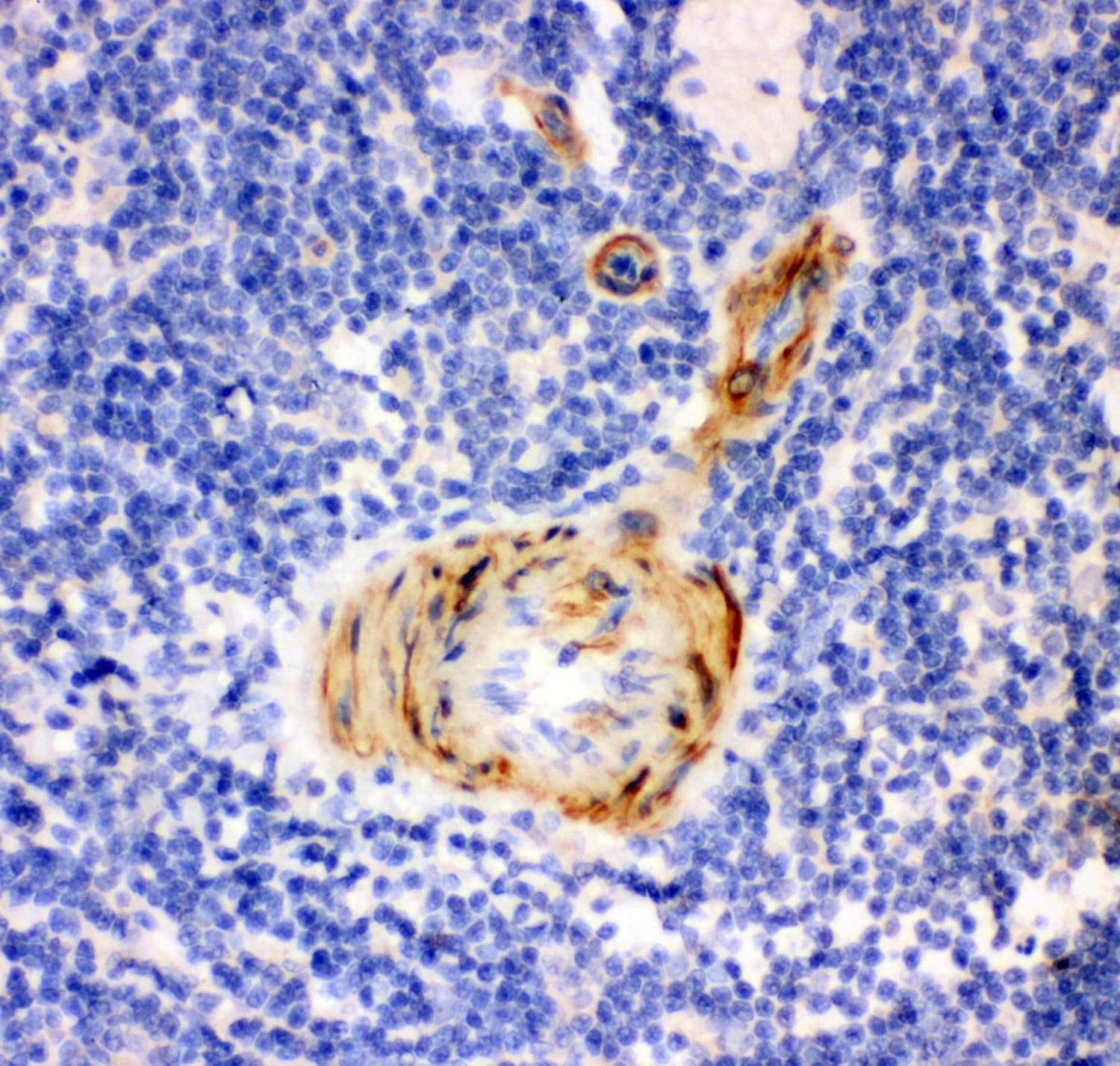 Polyclonal Rabbit anti-Human GSN / Gelsolin Antibody (aa580-782, IHC, WB)
