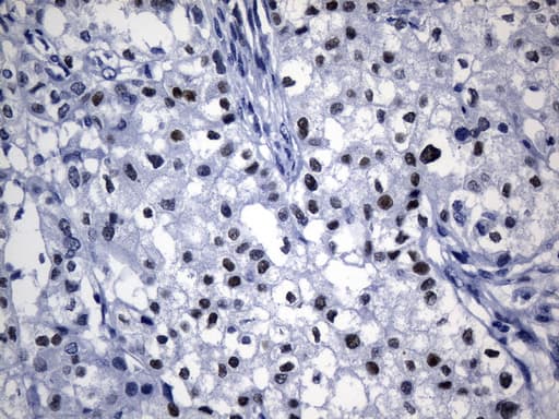 TLE1 / TLE 1 Antibody (aa180-460, clone UMAB253, Carrier-free)