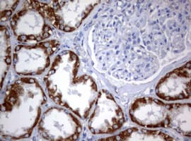 PIK3CD / PI3K Delta Antibody (aa286-610, clone OTI2H3)