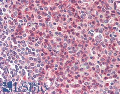 IHC-plus™ FGD6 Antibody