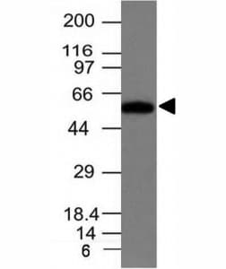 FSCN1 / Fascin Antibody (clone FSCN1/417)