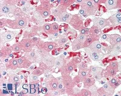 IHC-plus™ Polyclonal Rabbit anti-Human AHSP / EDRF Antibody (aa1-102, IHC)
