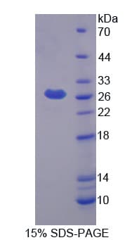 Mouse Prostaglandin D Synthase Protein (Recombinant His)