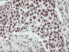 Monoclonal Mouse anti-Human NONO / P54NRB Antibody (clone OTI2E7, IHC, WB)