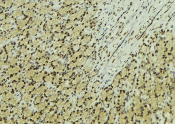 Polyclonal Rabbit anti-Human NUDT1 / MTH1 Antibody (IHC, IF, WB)