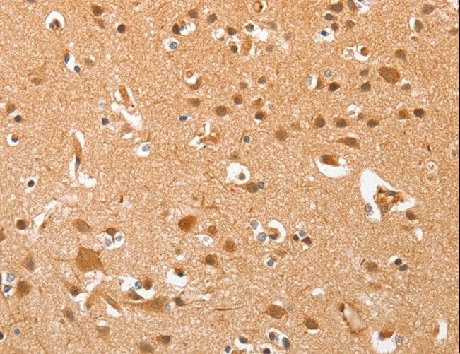 Polyclonal Rabbit anti-Human AHSG / Fetuin A Antibody (IHC, WB)